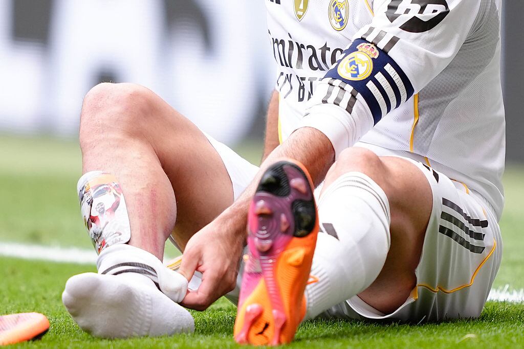 Imagen de la pierna de Carvajal tras recibir una entrada durante el derbi