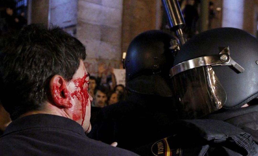 Un manifestante herido pide explicaciones a un agente