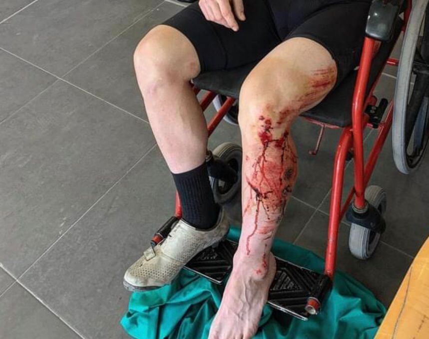 Ciclista accidentado en la Costa Blanca Bike Race. Calp