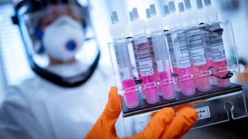 Los primeros resultados de la vacuna de Oxford son "seguros" y produce una reacción inmune ante el COVID-19