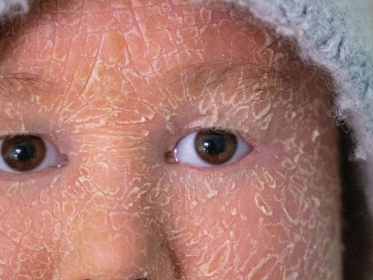 'La mirada del paciente': la exposición que recoge historias vitales marcadas por la enfermedad