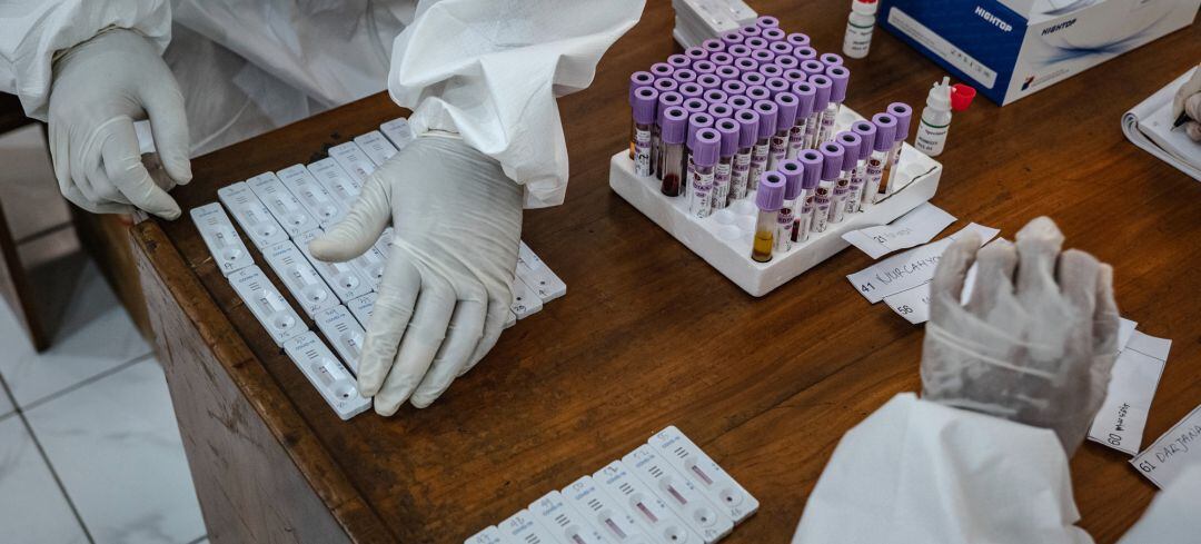 Imagen de la realización del test para detectar el coronavirus