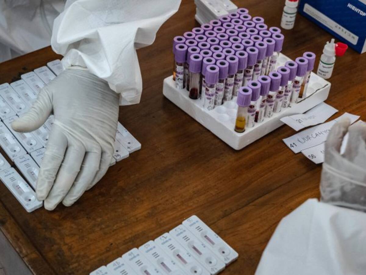 Un estudio de médicos e investigadores propone hacer test a la población de Albacete ante la desescalada
