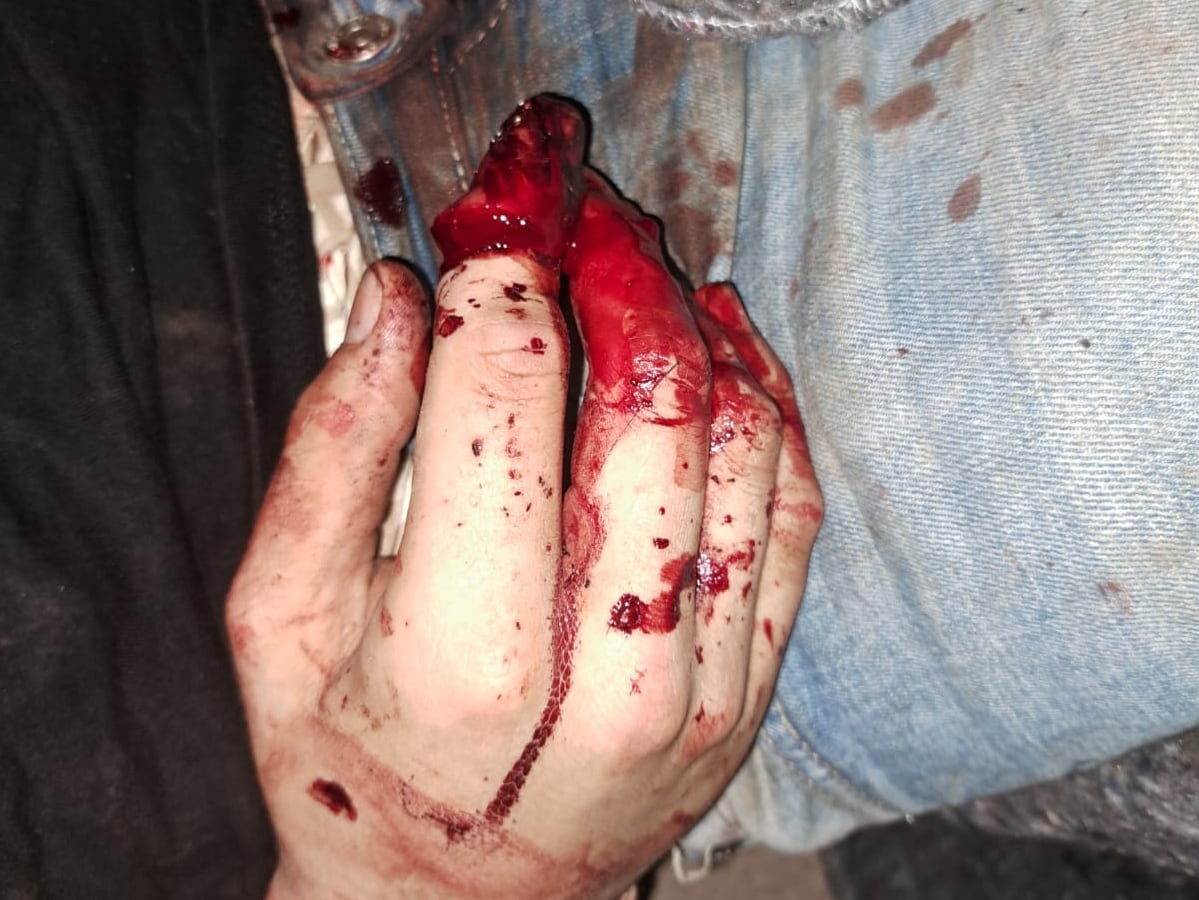 	La víctima fue localizada cerca de un descampado en la localidad malagueña de Fuengirola, con dos dedos de las manos amputados y cortes profundos en sendos pies