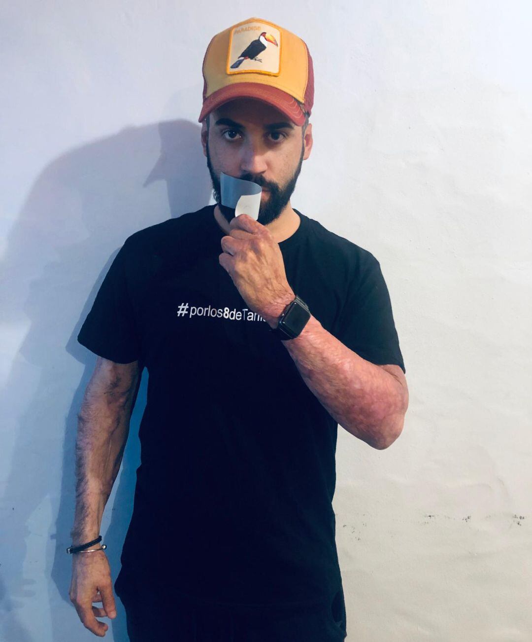 Fran Fernández, herido en el accidente del hotel 100% Fun se desprende de un esparadrapo en la boca.