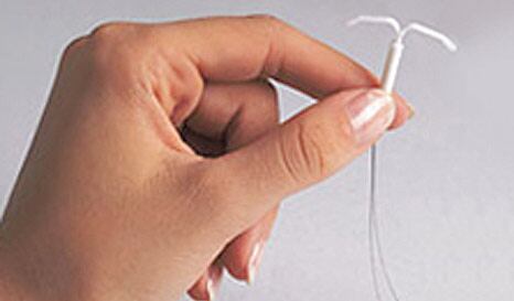 Imatge del dispositiu intrauterí anticonceptiu, DIU