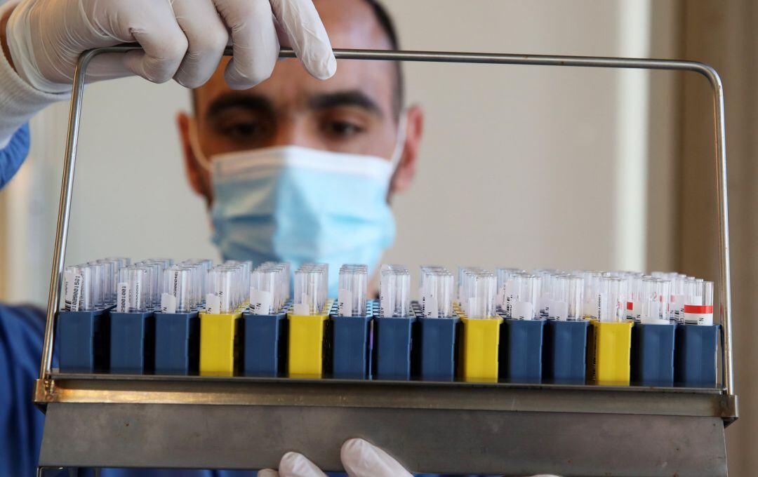 Análisis de pruebas PCR