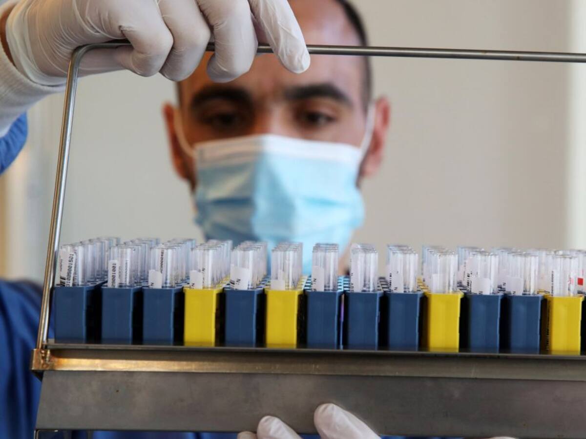 Valladolid suma 475 casos nuevos y cinco fallecidos, hasta rozar los 600