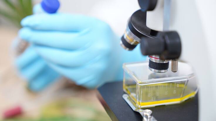 "Necesitamos esos tests cuanto antes"