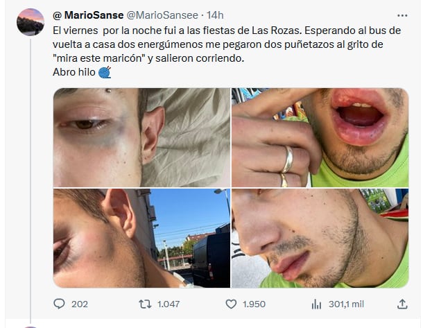 Las imágenes compartidas por un usuario de Twitter de su supuesta agresión durante las fiestas de Las Rozas