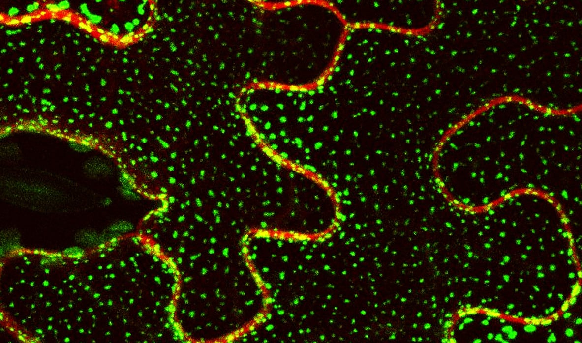 En la imagen usando microscopía confocal se ve la localización de la proteína Sinaptotagmina 1 unida a la proteína fluorescente GFP. Se puede observar cómo SYT1 se localiza en dominios específicos donde sirve de puente entre la membrana plasmática y membranas internas del retículo endoplasmático