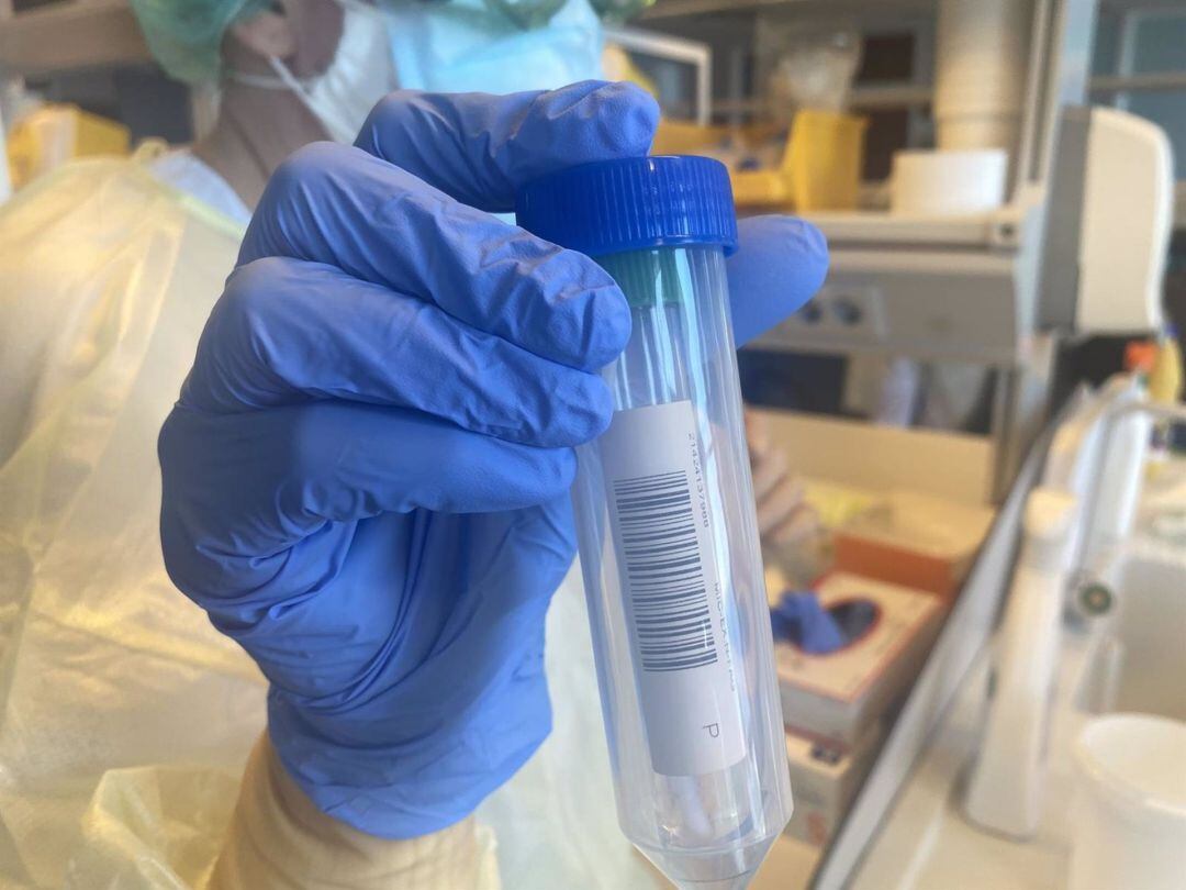 Imagen de prueba PCR cedida por la Consejería de Sanidad de Canarias