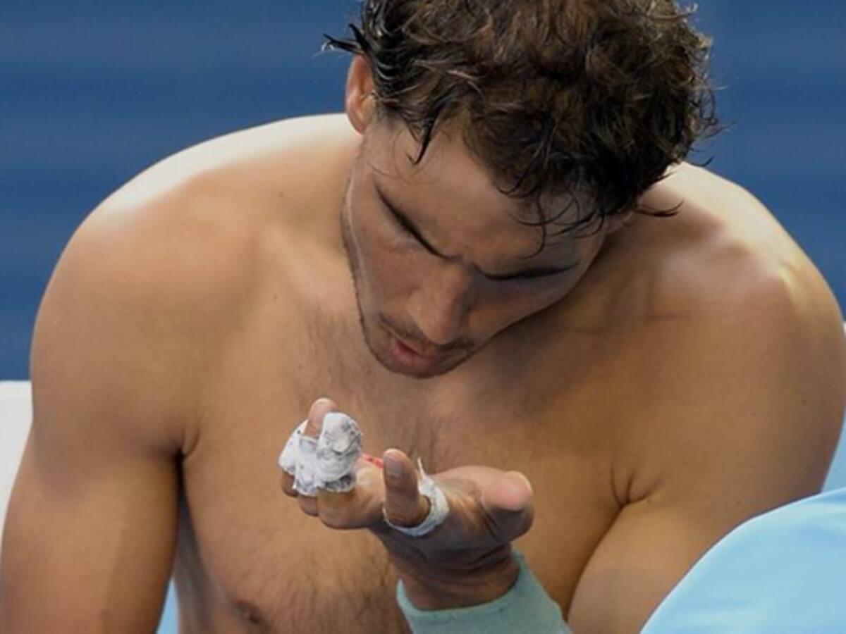 Rafa Nadal, preocupado por una herida abierta en su mano izquierda