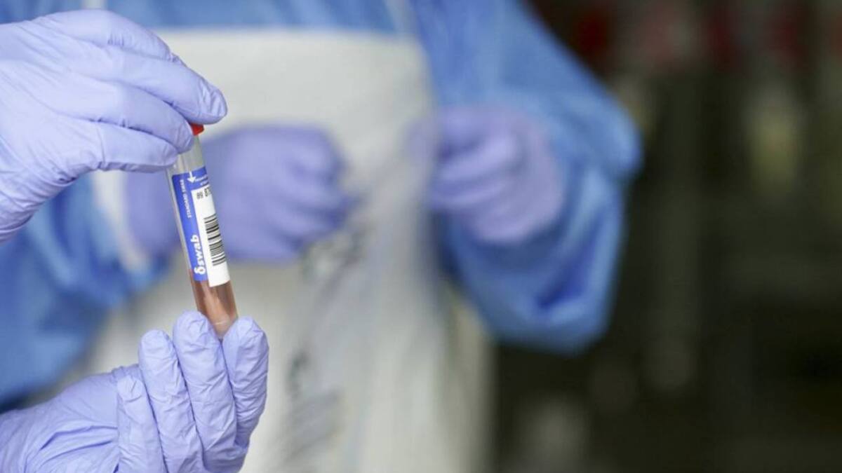 91 nuevos casos de COVID-19 en la provincia en solo 24 horas