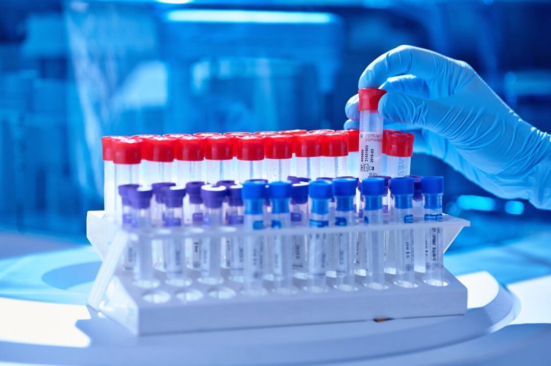 Realización de pruebas PCR