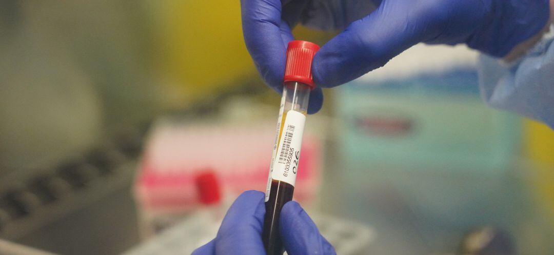 Archivo - Una enfermera durante el ensayo clínico de la vacuna alemana Curevac en el que participan diariamente 50 voluntarios, en el Hospital de Cruces de Barakaldo, en Euskadi