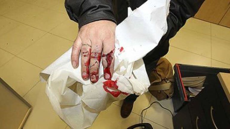 Imagen de la agresión sufrida por uno de los fotógrafos.