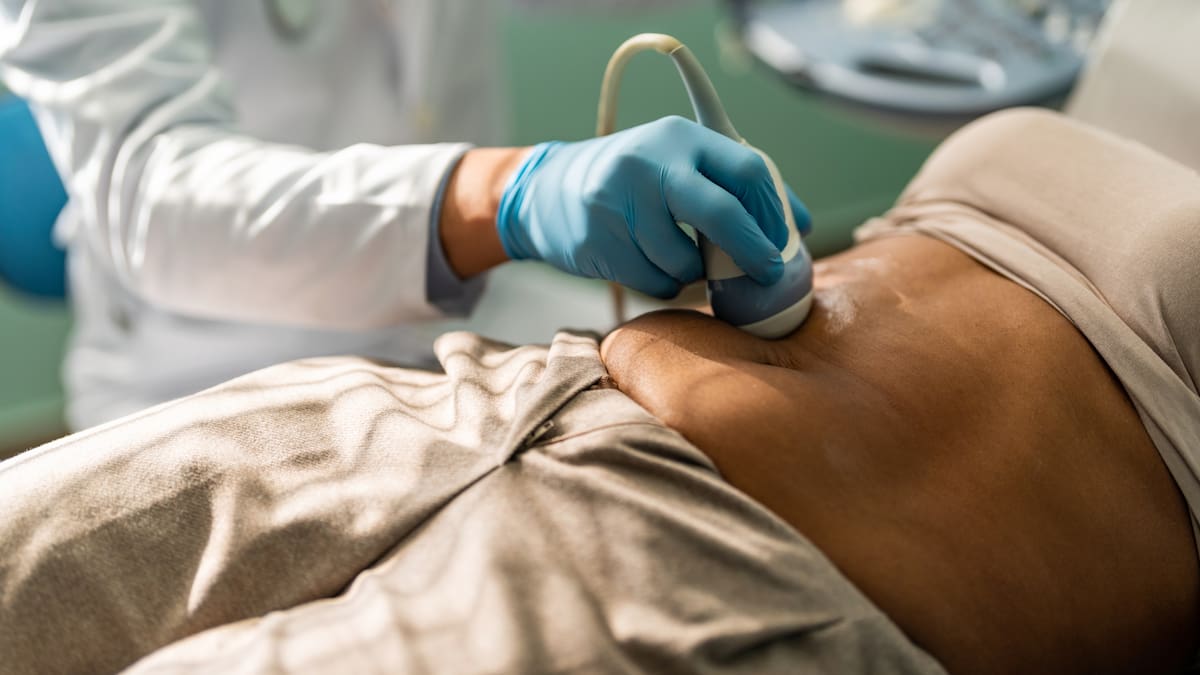 El científico Mariano Barbacid logra eliminar el cáncer de páncreas más común en modelos animales