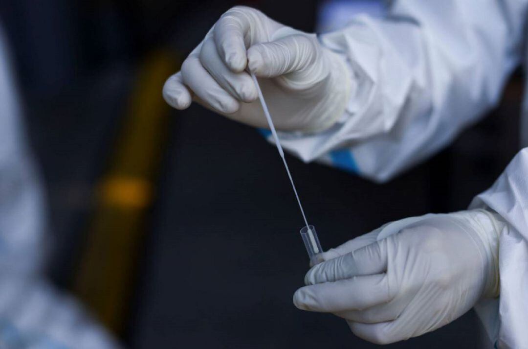 Imagen de un test PCR.