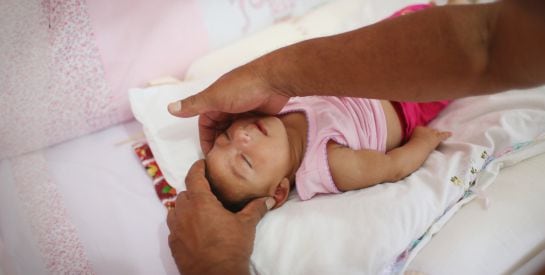 Alice Vitoria Gomes Bezerra, de tres meses, ha nacido con microcefalia en Arrecife (Brazil).