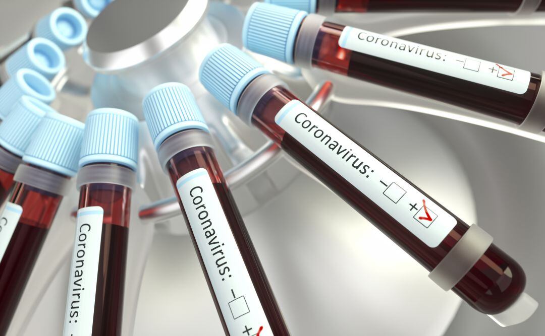 Muestras de sangre para test de coronavirus