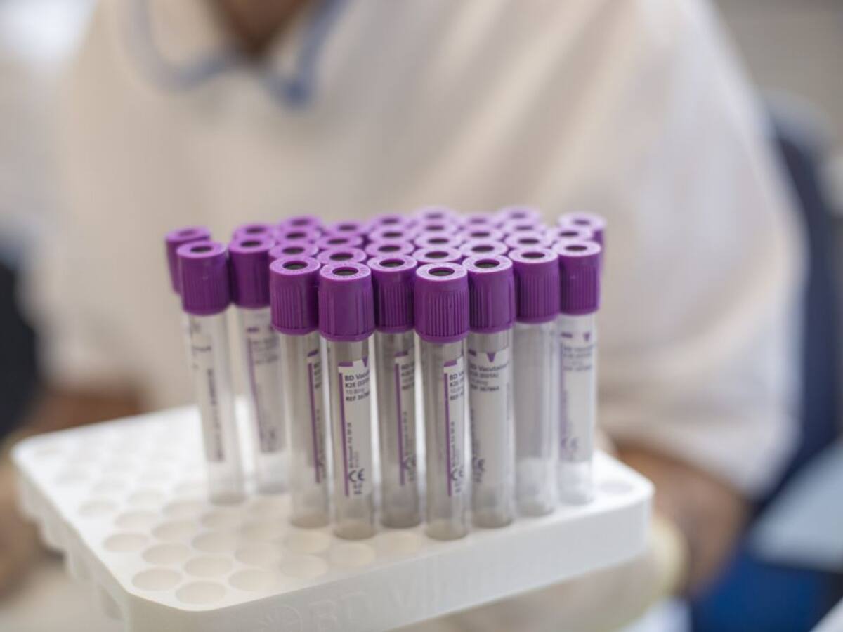 "Con test a los asintomáticos podría verse si España ha alcanzado la inmunidad de rebaño antes que otros países"