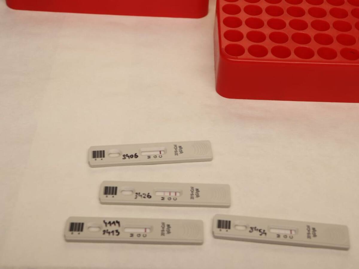 Más de 1.800 casos activos en las Pitiusas, 48 de ellos hospitalizados