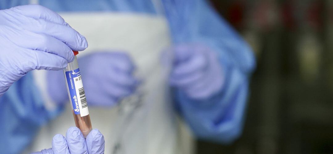 Análisis PCR. Imagen de archivo.