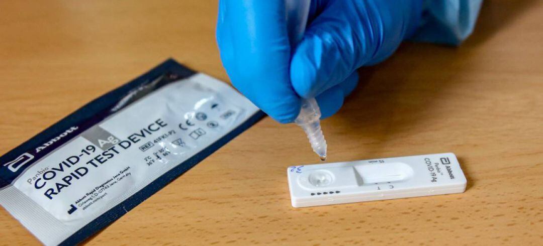 Imagen de archivo de una prueba de antígenos