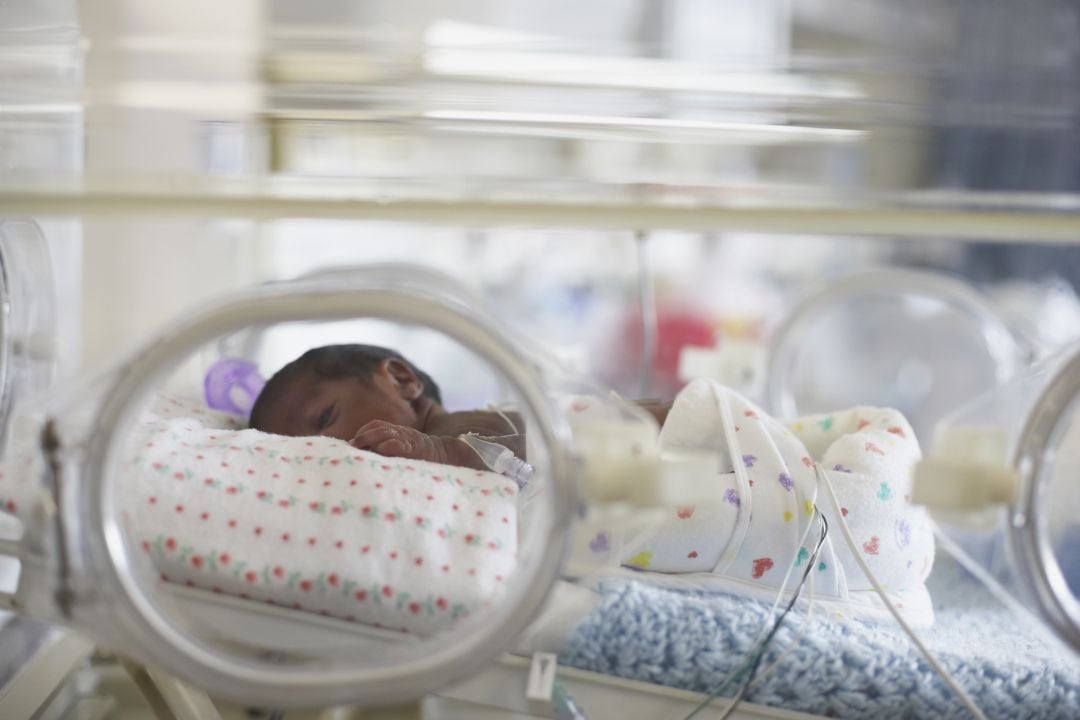 Un bebé prematuro en el hospital.