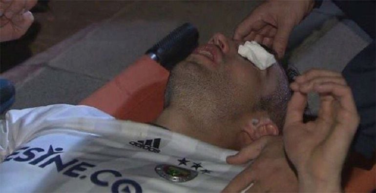 Robin Van Persie, con el ojo cubierto tras el codazo que sufrió