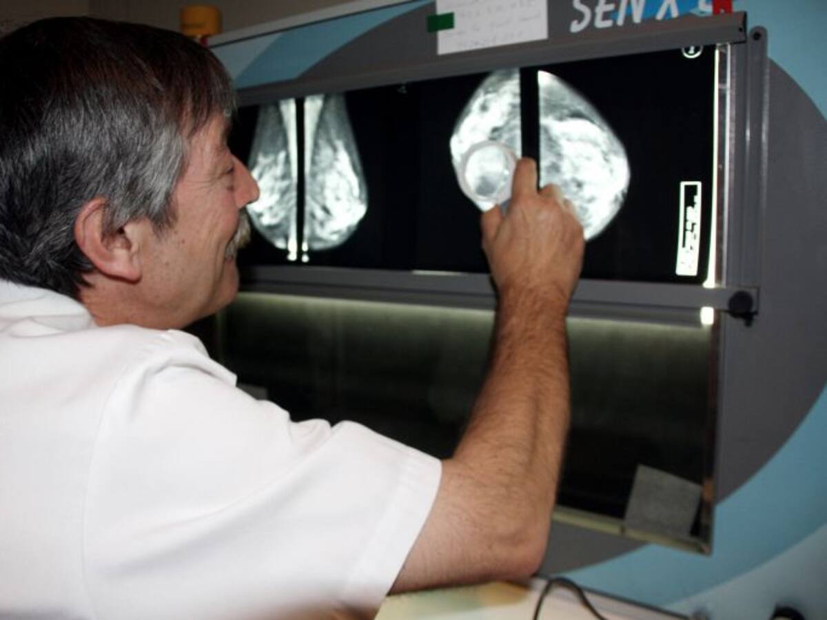 La detecció precoç del càncer de colon arriba a l'Alt Camp i la Conca