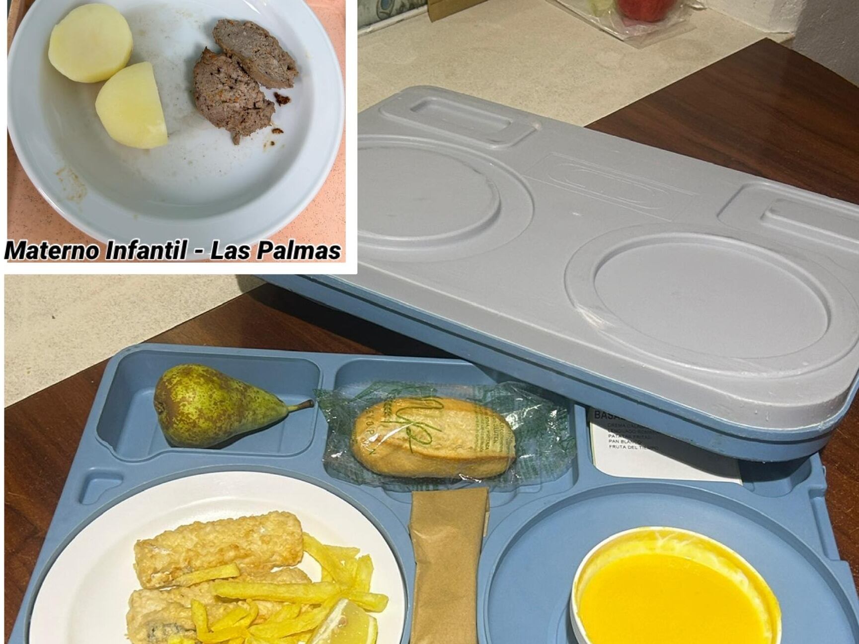 El padre de Elías Herrero muestra en redes sociales la comida del Materno Insular en comparación a la actual que recibe el niño en Madrid