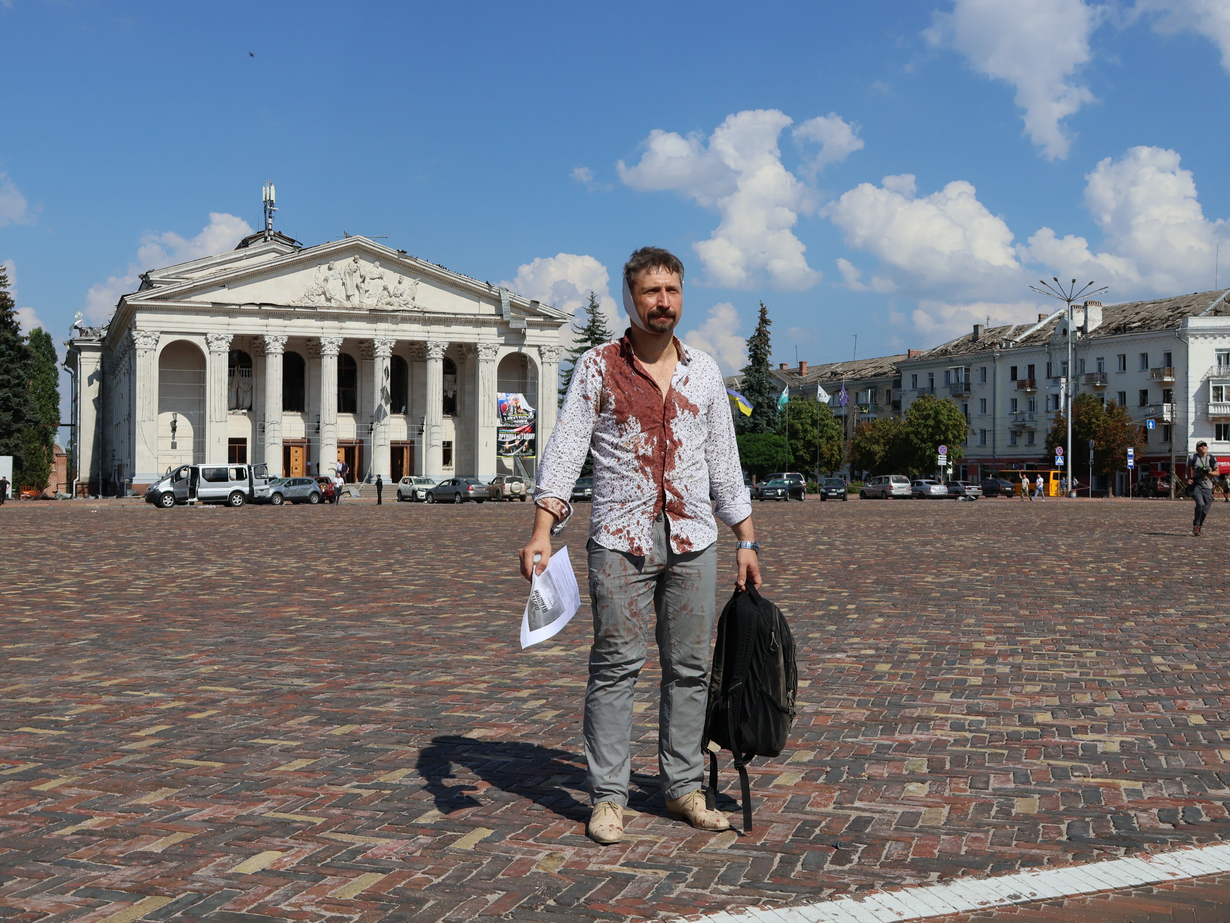 Un ciudadanos ucraniano con la camisa empapada en sangre frente al teatro de Chernihiv bombardeado durante la madrugada del sábado por Rusia