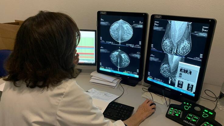 Entrevista Día Mundial contra el Cáncer de Mama