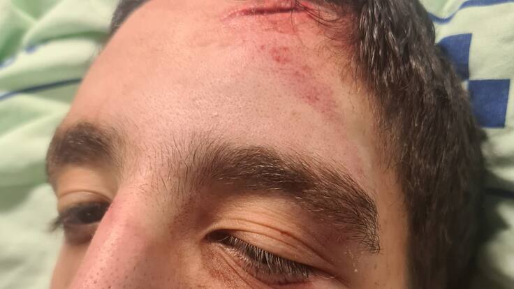 "No puedo más": la desesperación de una madre de dos hijos con parálisis cerebral enciende todas las alarmas