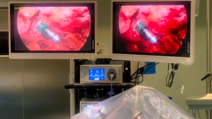 Israel Manzanedo Romero, cirujano general y del aparato digestivo del Hospital Universitario de Fuenlabrada