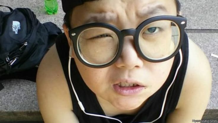 El extraño síndrome que provoca que haya adultos atrapados en el cuerpo de un niño