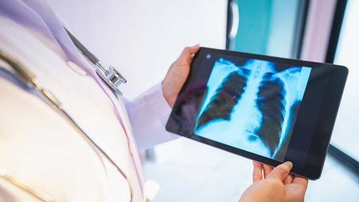 Hora 14 Región de Murcia (09/01/2024)