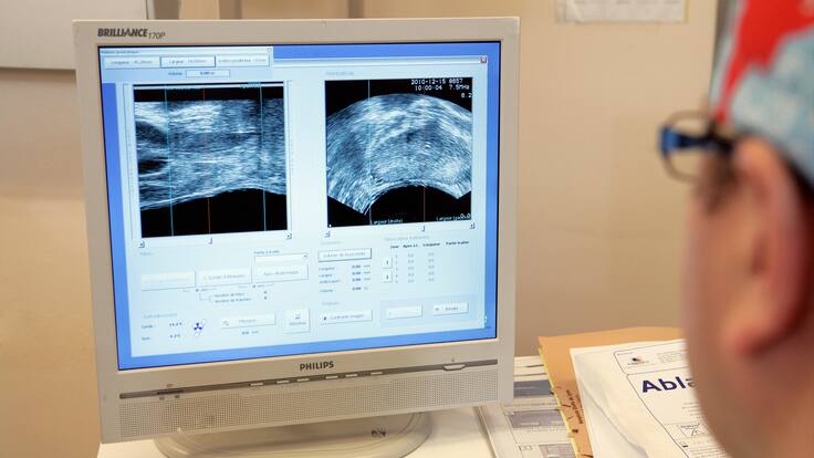 La lotería del cáncer y cómo evitarla