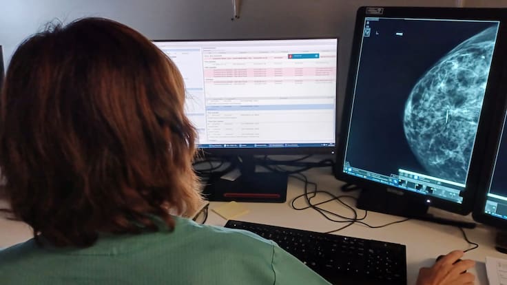 Bernabé Castro, presidente Sindicato Médico Jaén: "Una vez que te quitan tres radiólogos para hacer mamografías para dejar otras actividades, hay un incremento de las listas de espera"