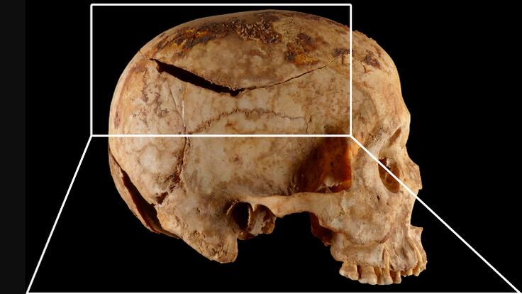 Empoderada e intolerante a la lactosa: Así es el Elba, la primera pastora gallega
