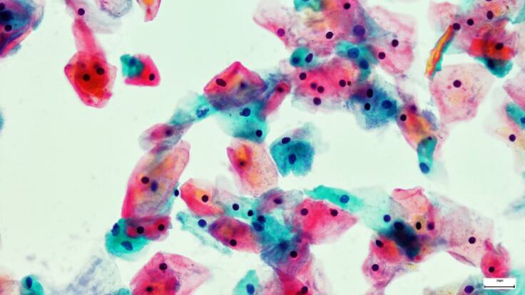 Los últimos avances contra el cáncer, a debate en León (07/10/2022)