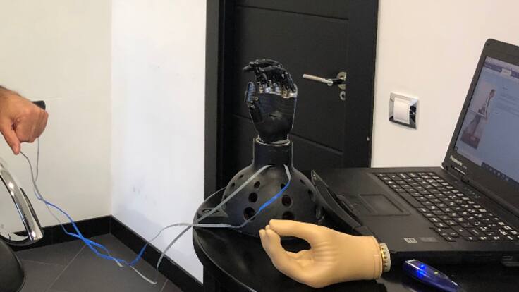 Ni biónicas ni asequibles