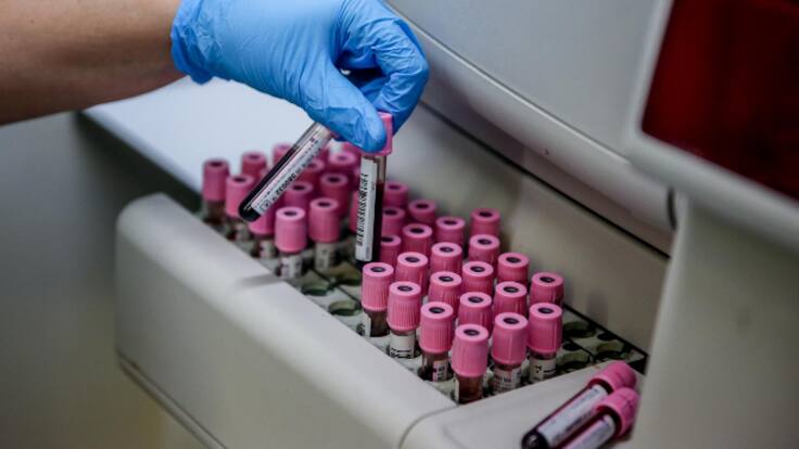 Infectados por COVID-19 con grupo sanguíneo 0 tienen menor riesgo de ingreso en UCI (19/07/2022)