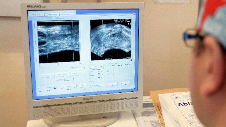 Entrevista a Josep Tabernero. Més de 10.000 pacients de càncer s'han beneficiat a Catalunya de l'oncologia de precisió durant el 2022