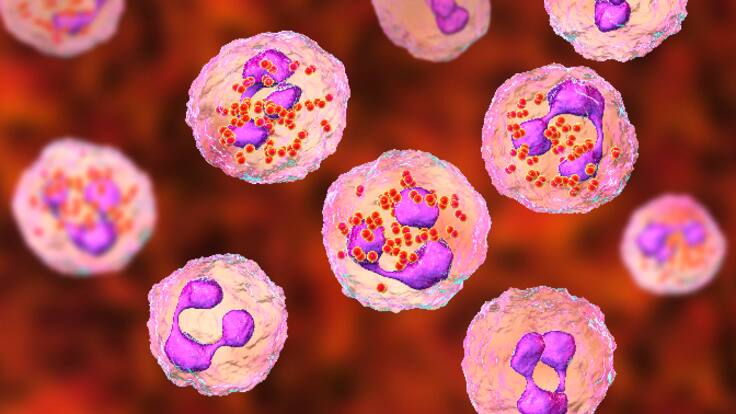 En el Día Mundial de las Enfermedades Raras, varios pacientes reclaman una mayor visibilidad social y más ayudas públicas