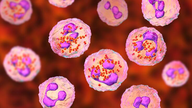 Conversamos acerca del Día Mundial de las Enfermedades Raras con Barbara Congost, presidenta de la Asociación de Enfermedades Minoritarias de la Comunitat Valenciana