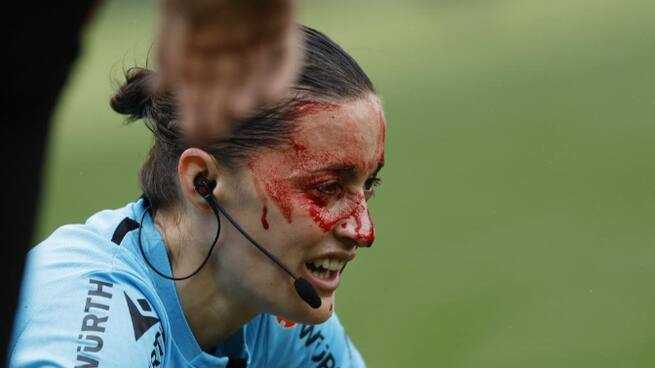 Aviso a LaLiga por el accidente con Guadalupe Porras: "Si le pasa a Lewandowski o a Bellingham... hay un escándalo mundial"