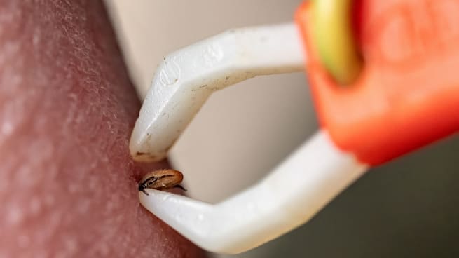 Entrevista a Jorge Alba, médico de enfermedades infecciosas, sobre las picaduras de garrapatas